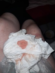 Is this implantation bleeding