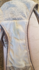 5 weeks pregnant with this discharge this this normal?