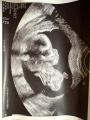 14 weeks gender