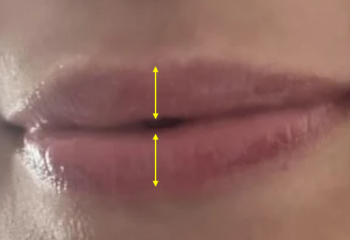 What could be done with my lips? Pics