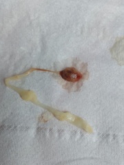 What is this that i passed in bath