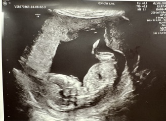 14 weeks gender