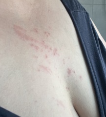 What’s this rash?