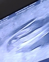 Potty shot clarity?