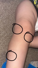 Spots?