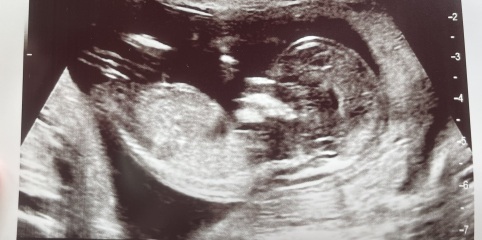 Girl or Boy predictions?