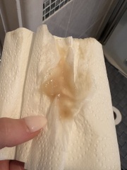 Mucus plug?