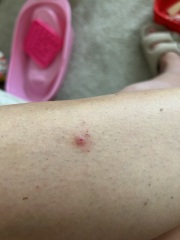 Weird spot on leg