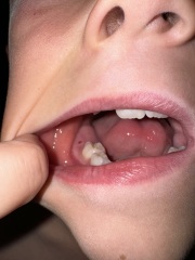 Any dentists? What is this? Photo