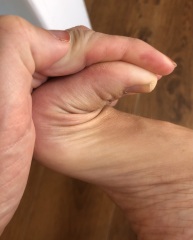 Is it normal for my toes to be able bend this much?