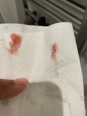 11 weeks 5 days pregnant having bleeding