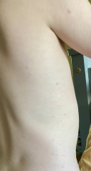 Have we got the dreaded chicken pox?