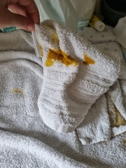 Is this normal? (Tw poo pic)
