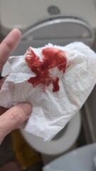 Help is this implantation bleeding
