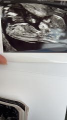 Due February 2025 - Thread 3