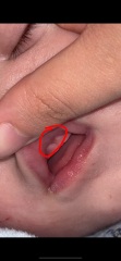 Teething baby