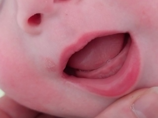 When will these teeth cut through?!