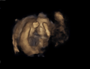 Due February 2025 - Thread 3