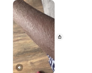 Any dermatologists around please?  Skin condition