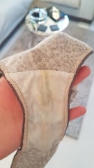 5 weeks pregnant with this discharge this this normal?