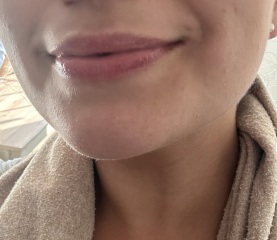 What could be done with my lips? Pics