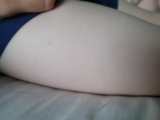 Please help identify these spots/bites