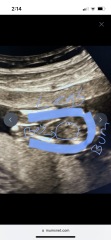 Help with potty shot 14 weeks