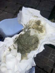 Help. Baby so cross despite changing t milk. Warning nappy photos attached!