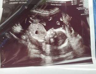 Gender Guesses - distraction needed!