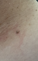 Beautiful gunk from neck...