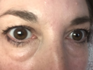 Please fix my eyebags