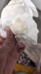 Help is this implantation bleeding