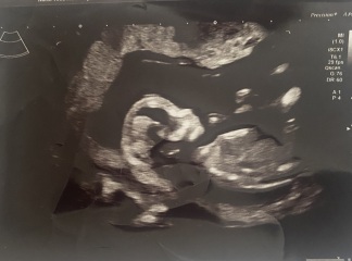 Do you want me to guess the sex? 12 week scans.