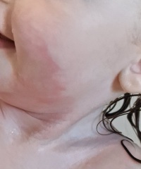 Allergies? Or just skin irritation?