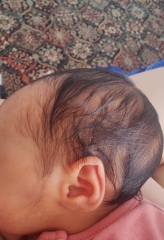 Does my baby have flat head?