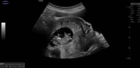 Due February 2025 - Thread 3