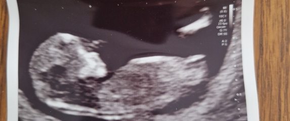 Gender guess?