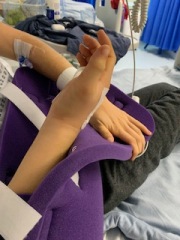 Hand infected (Warning, gross photos)
