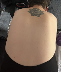 Bad posture or something more?