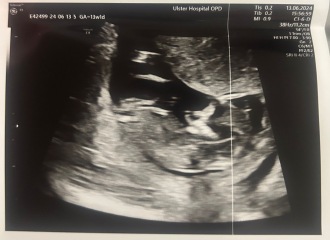 Gender Guesses - distraction needed!