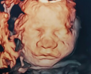 Pregnant over 40