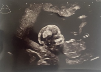 Do you want me to guess the sex? 12 week scans.