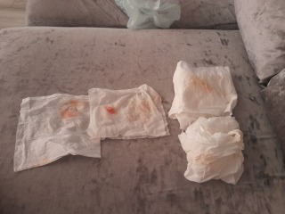 Is this implantation bleeding