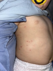 Rash on 7 month old