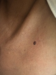 Moles