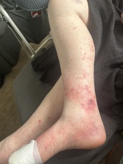 Any drs/nurses can help identify this pls?