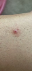 Weird spot on leg