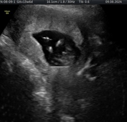 Scan Gender Ideas?