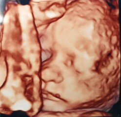 Pregnant over 40