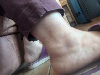 Sprained ankle still swollen after 10 days